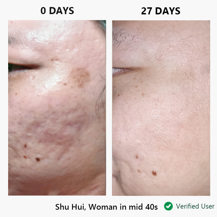 nor sken restore™ one-step facial cream