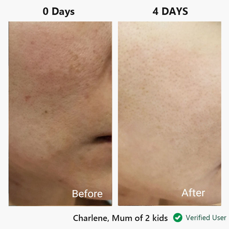 nor sken restore™ one-step facial cream