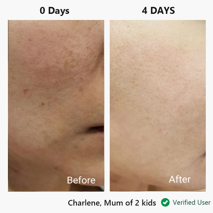 nor sken restore™ one-step facial cream
