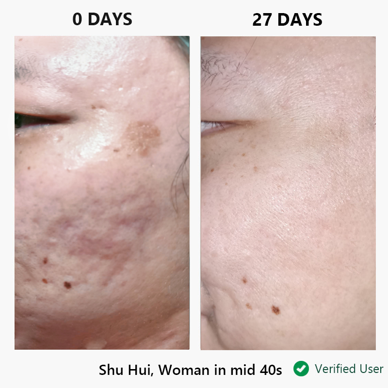 nor sken restore™ one-step facial cream