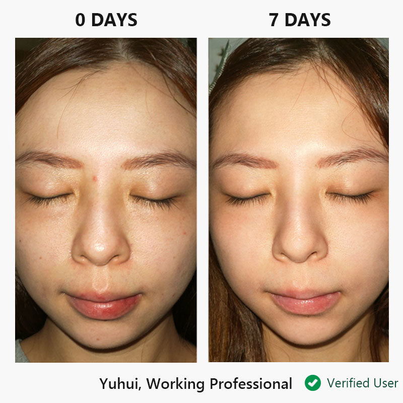 nor sken restore™ one-step facial cream